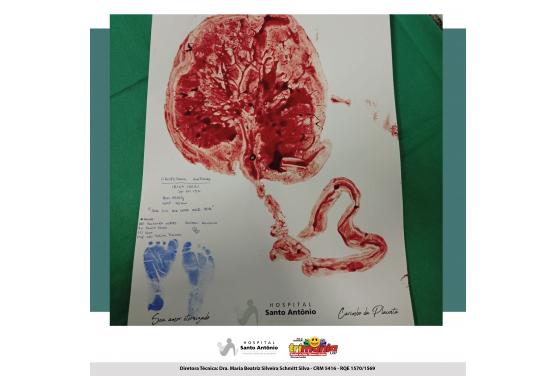Carimbo da Placenta eterniza a emoção do nascimento no Hospital Santo Antônio.