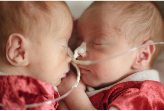 Bebês da UTI Neonatal e UCIN do Hospital Santo Antônio de Blumenau fazem ensaio fotográfico natalino