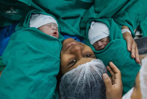 Liam e Ian: Primeiros Gêmeos de 2025 em Blumenau, nascem no  Hospital Santo Antônio